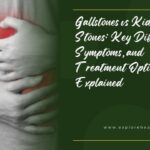 Gallstones vs Kidney Stones