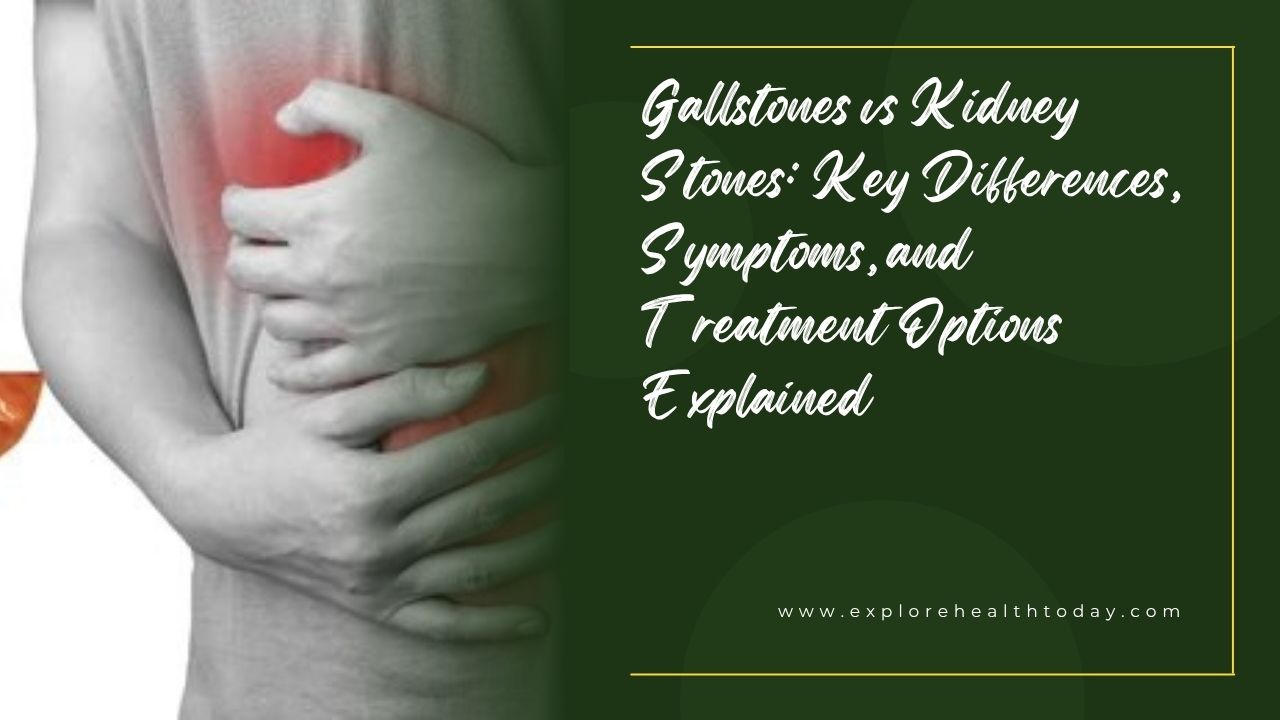 Gallstones vs Kidney Stones