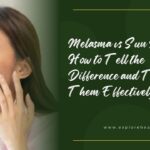Melasma vs Sun Spots