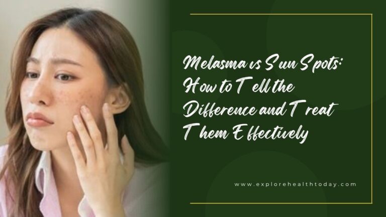 Melasma vs Sun Spots